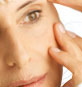 blepharoplasty