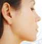 nose surgery